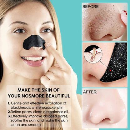 Unisex Blackhead Remove Mask Peel Nasal Strips Deep Shrink Cleansing Pore Nose Black Head Remove Stickers Skin Care Mask Patch